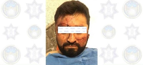 Sujeto a proceso penal el ladrón golpeado por comerciantes en El Coecillo