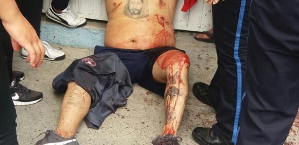 Le disparan en el Fraccionamiento Hidalgo