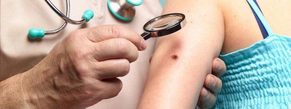 Exposición prolongada a rayos solares predispone a padecer cáncer de piel