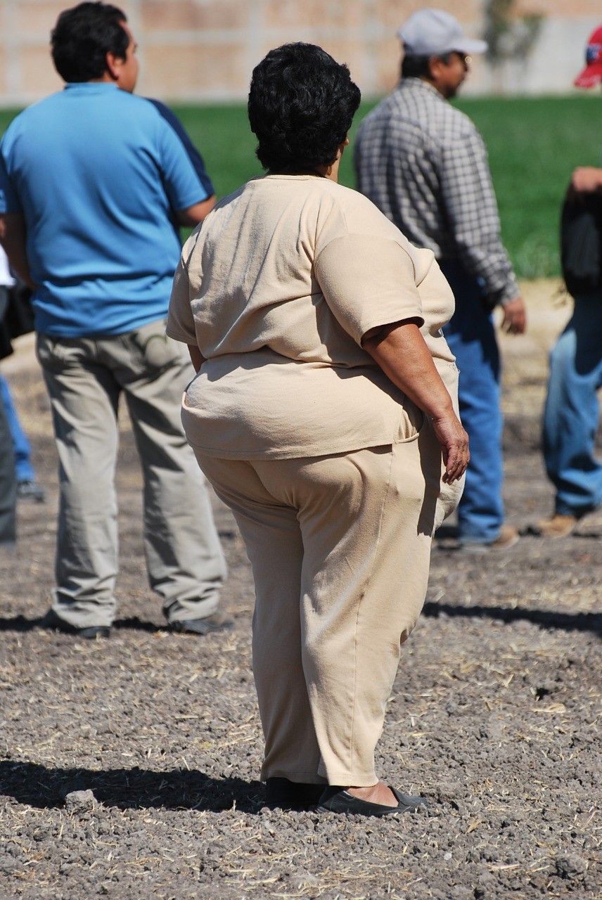 Crecen 20% casos de obesidad en Guanajuato