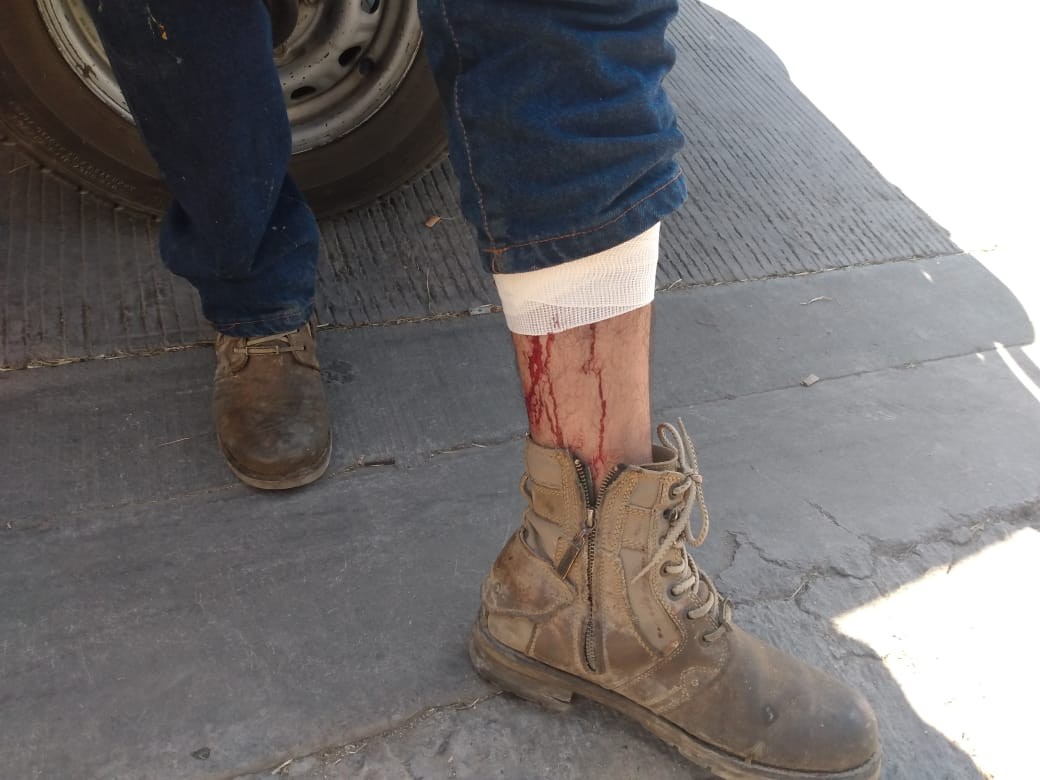Balean a hombre en Hacienda Los Otates
