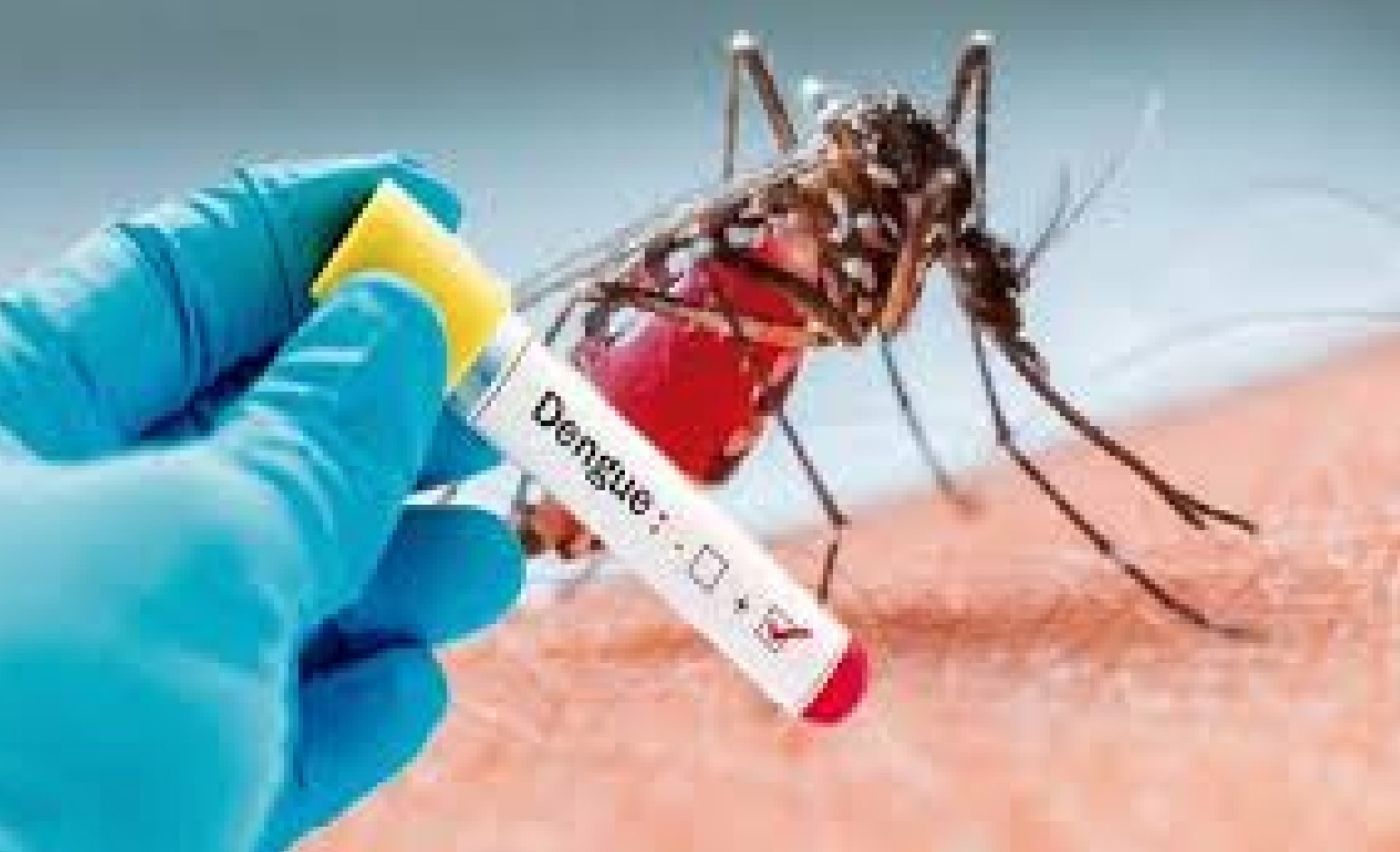 Detectan primer caso de 'covidengue' en León