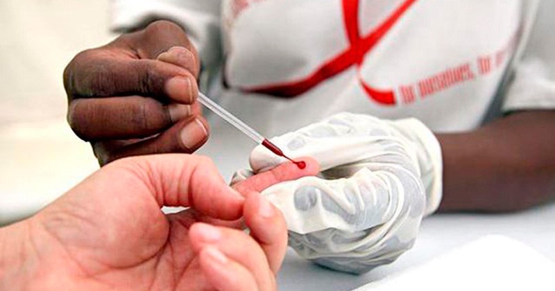 Atienden a 2 mil 799 enfermos de Sida en los capasits