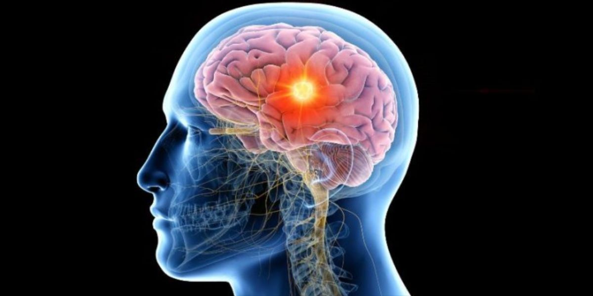 Investigan nueve casos sospechosos de meningitis en Guanajuato