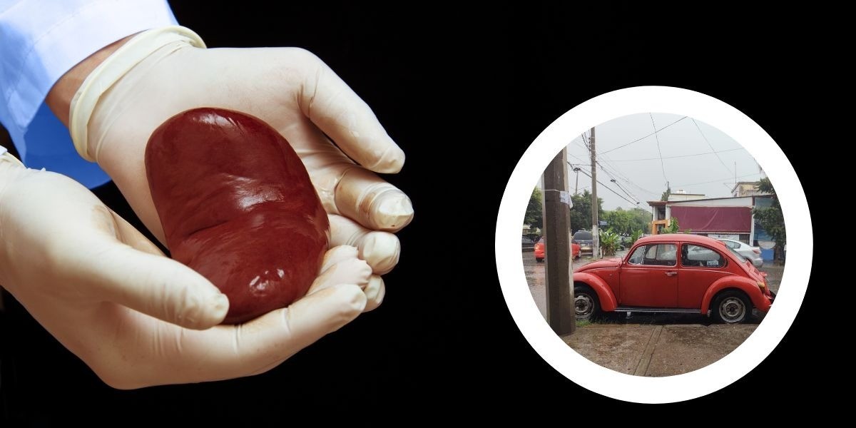 Frenan ladrones de vocho trasplante de riñón para Jesús