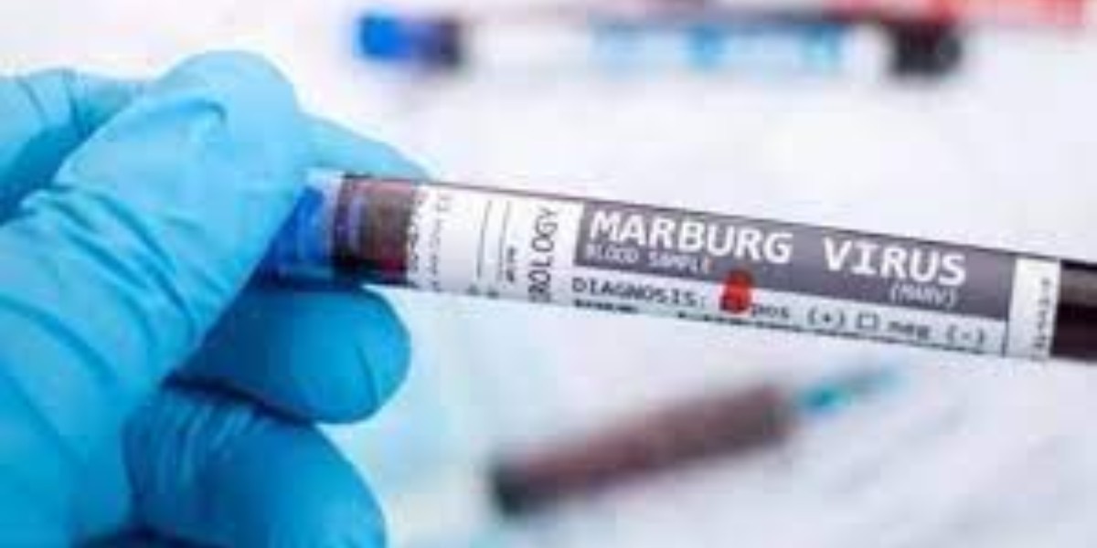 ¿Qué se sabe sobre el virus llamado Marburgo?