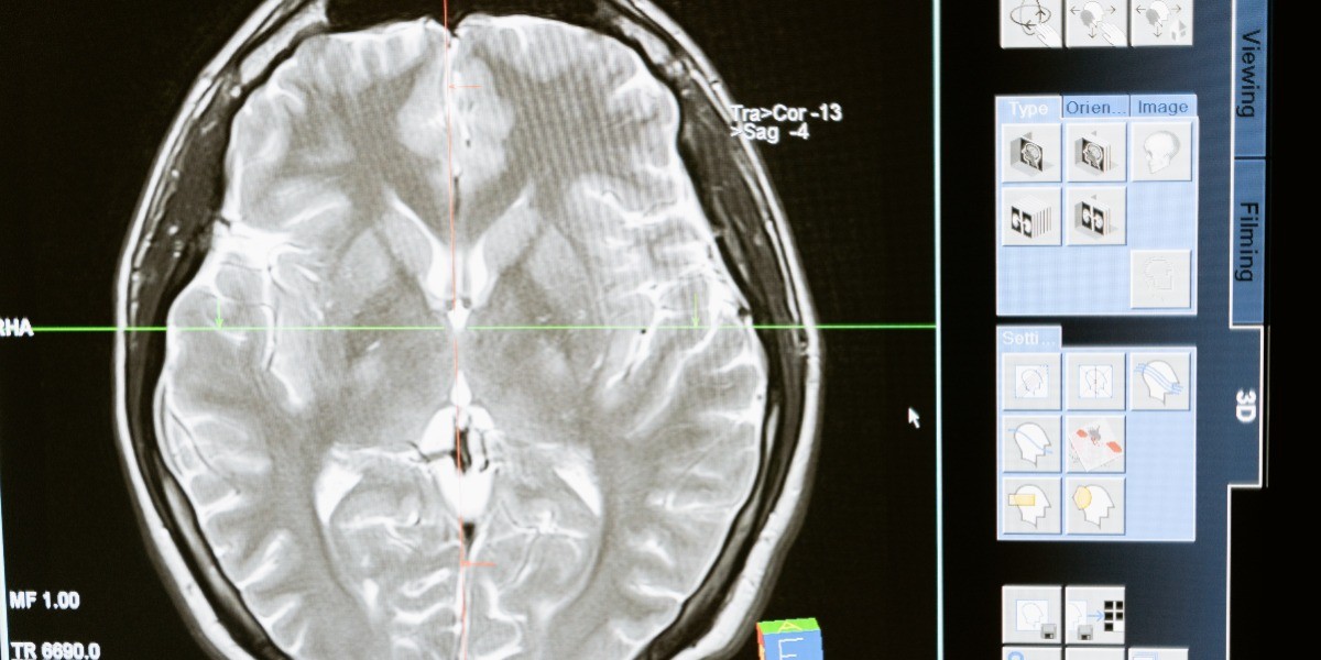 Disminuyen casos de meningitis en el estado