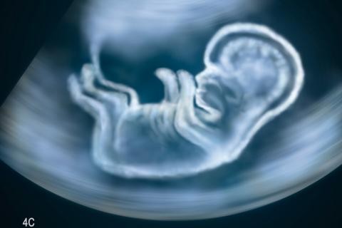 ¡Histórico! Realizan la primera operación al cerebro de un feto