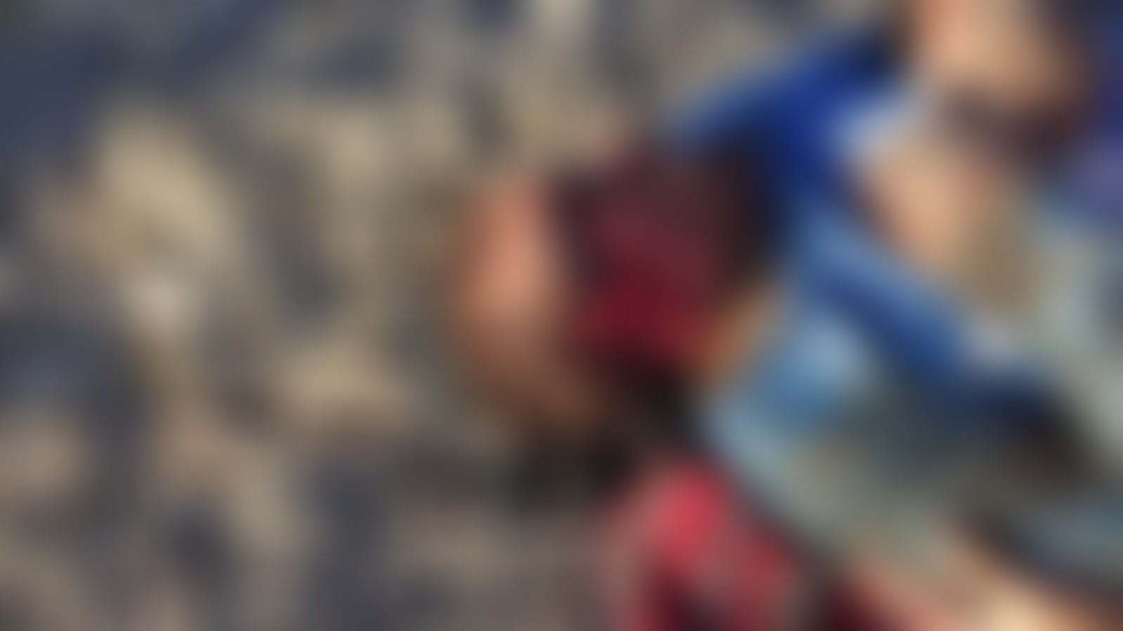 Perros le desfiguran la cara a hombre en la colonia 10 de Mayo