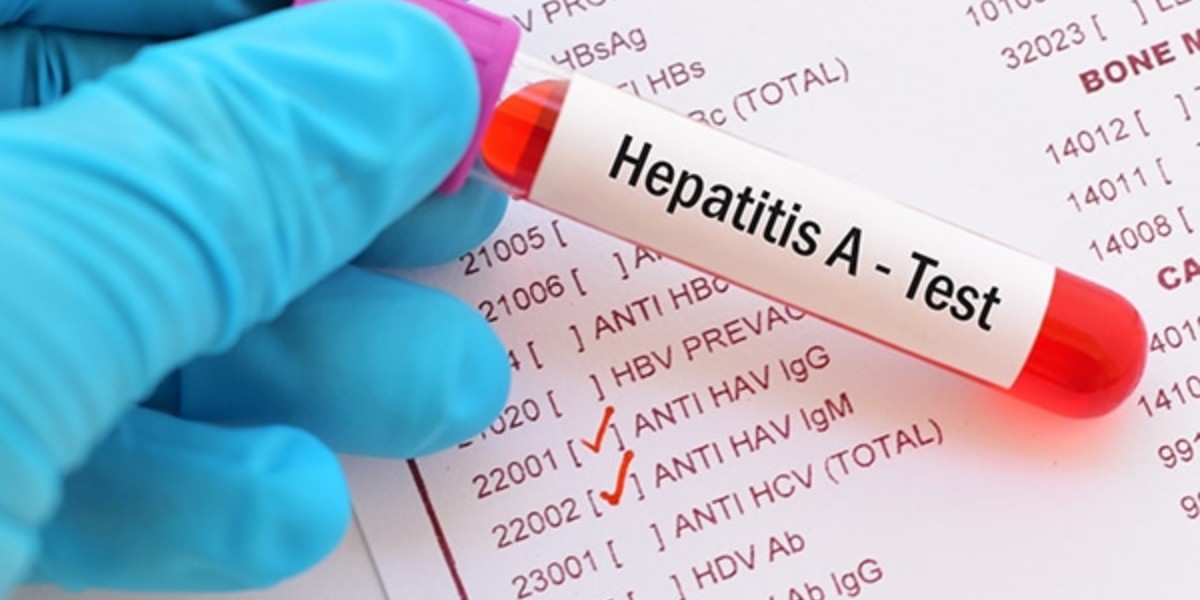 Incrementan atenciones médicas por hepatitis un 40% en Guanajuato