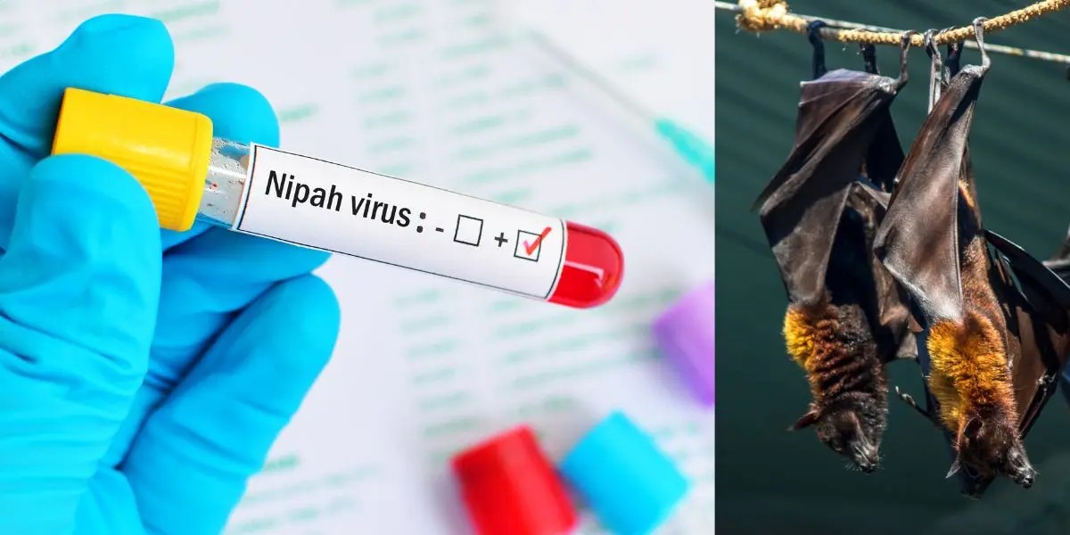 ¿Puede el virus Nipah provocar una pandemia? Alejandro Macías responde