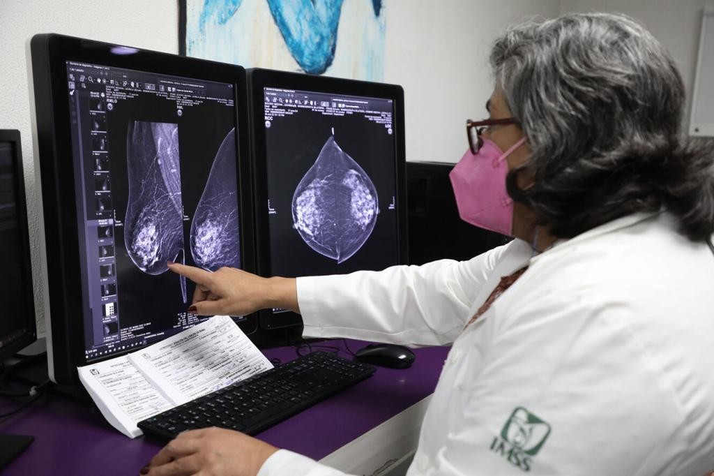 ¿Cómo atiende el IMSS Guanajuato el cáncer de mama?