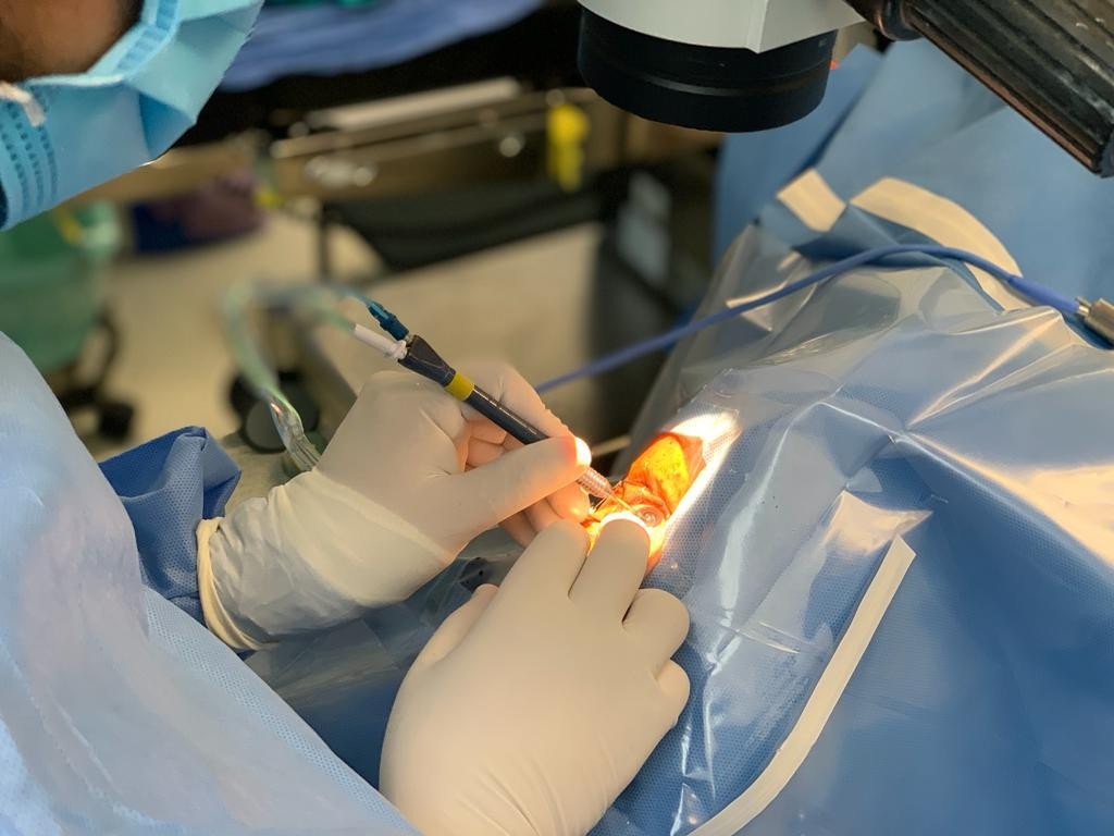 IMSS Guanajuato alista jornadas de cirugías de catarata