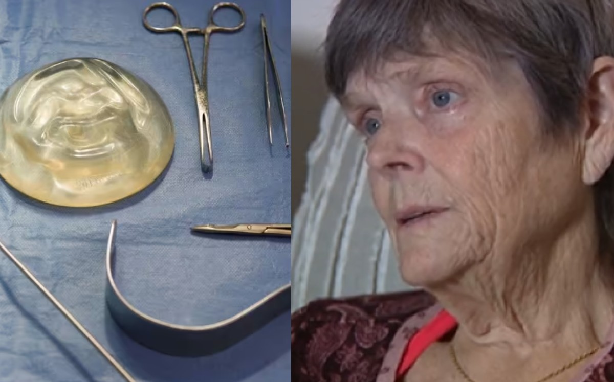 Abuelita entra a cirugía y despierta con implantes que no solicitó en Tijuana