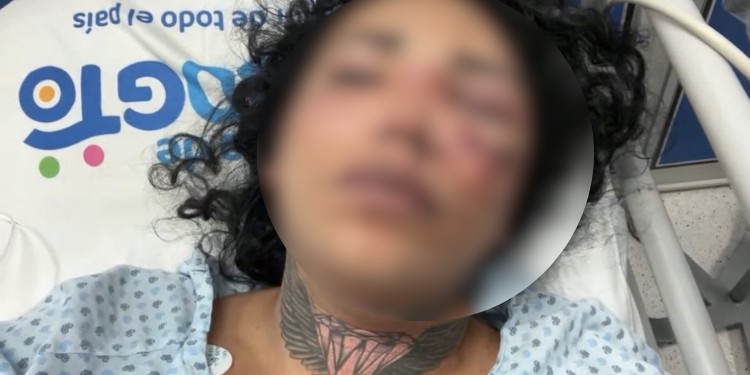 Paola Suárez de 'Las Perdidas' es golpeada brutalmente por su novio