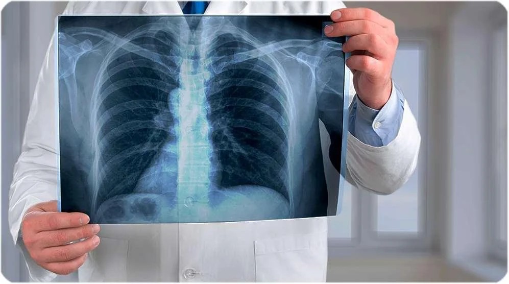 Existe déficit de radiólogos en Guanajuato, estos son algunos municipios