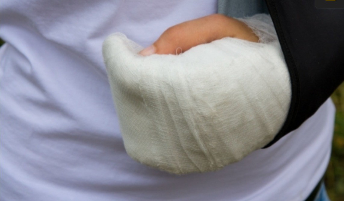 Niño mete la mano a una centrifugadora y le amputan un dedo