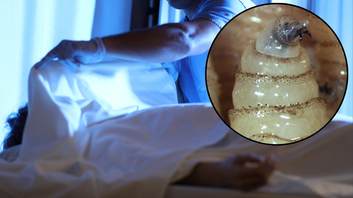 Muere mujer a causa del Gusano barrenador, es la primera muerte en México