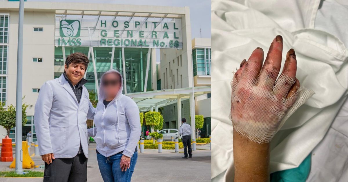 Médicos del IMSS en León salvan la vida y extremidades de mujer tras explosión por fuga de gas
