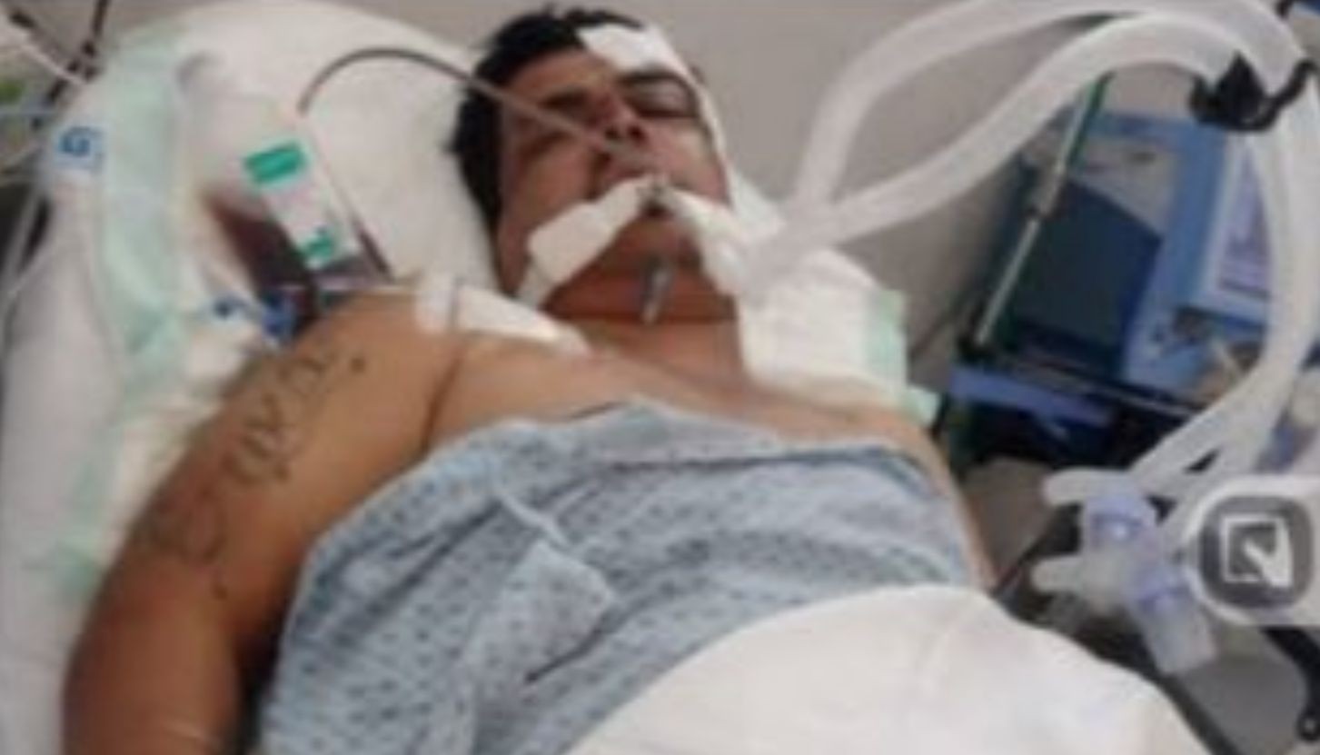 Hombre queda grave tras caer en un bache en León; su familia pide ayuda