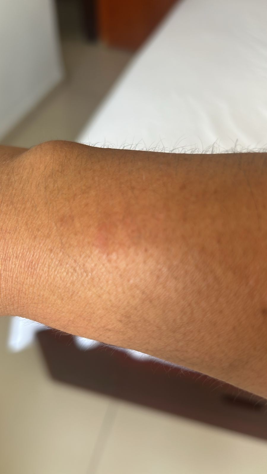 Brote de dengue en León: vecinos del fraccionamiento San Miguel exigen fumigación en sus casas