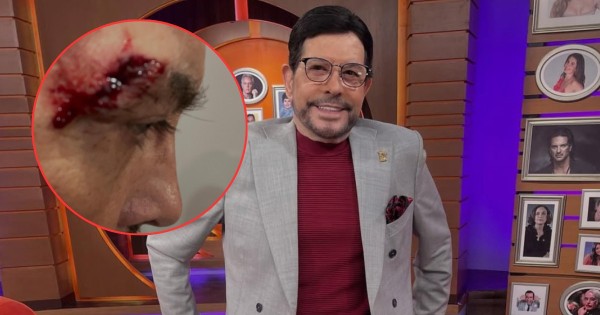 Pepillo Origel sufre fuerte caída y revela consecuencias del golpe