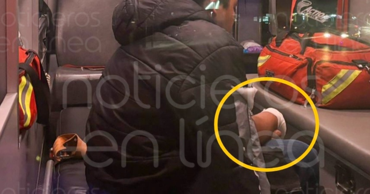 Menor de 13 años jugaba con cuetes cuando uno le explotó en la mano