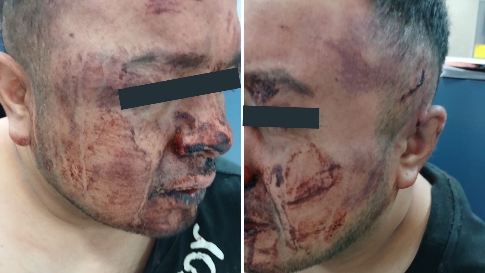 Terror en Lomas de Echeveste: Denuncian golpiza y robo por parte de policías de León