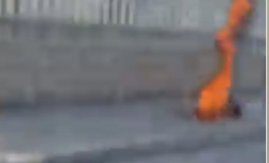 Prende un cigarro y termina en llamas: adulto mayor sufre quemaduras de tercer grado