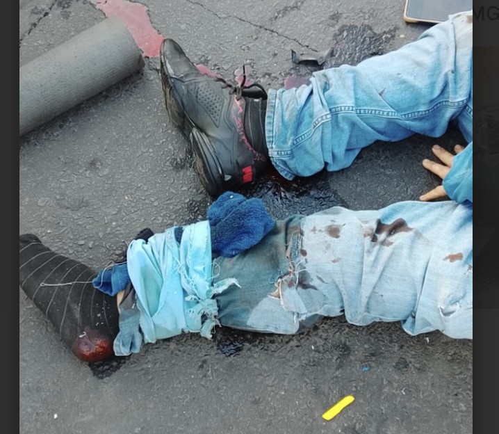 Motociclista resulta gravemente herido tras accidente en la colonia Girasoles