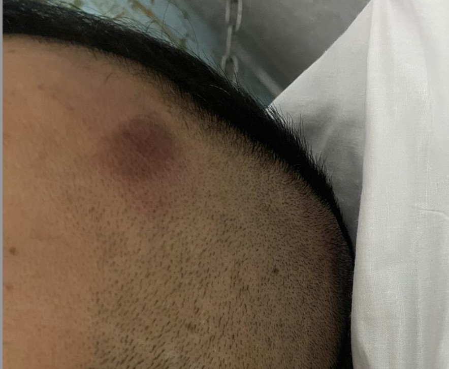 PRODHEG inicia queja de oficio por agresión a periodista durante cobertura en Juventino Rosas