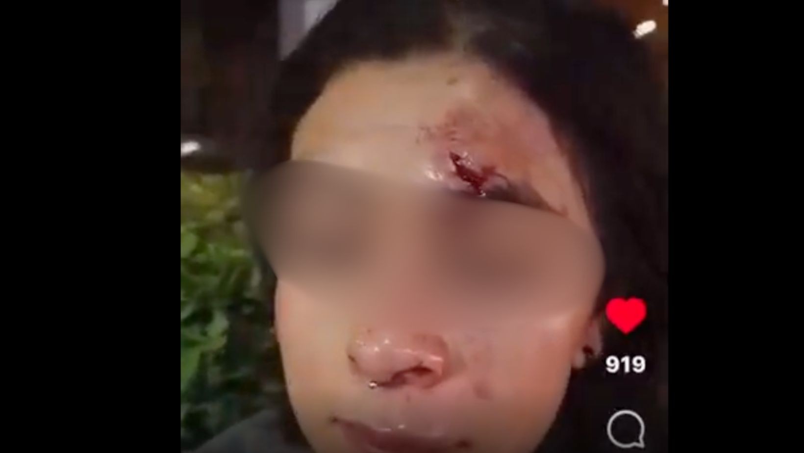 Golpean a joven en asalto cerca del Fórum Cultural en León