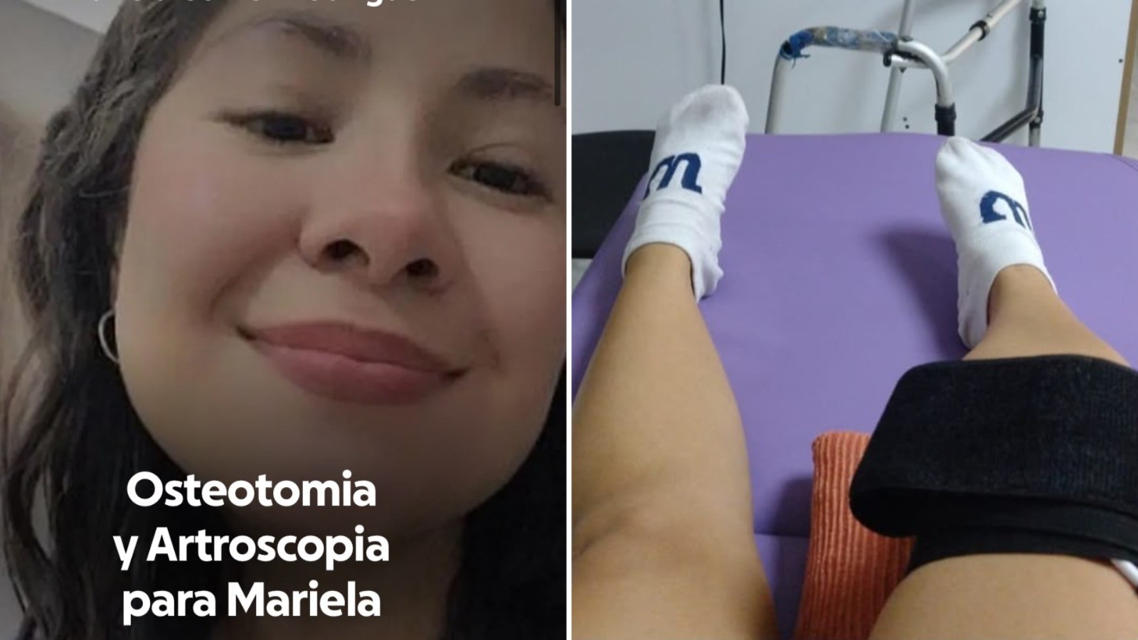 Una kermés por Mariela en León: buscan reunir 350 mil pesos para sus cirugías