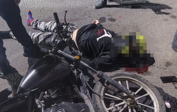 Grave motociclista tras chocar contra un auto en la México-Japón