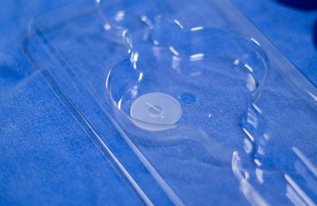 Pioneros: instalan el primer dispositivo para glaucoma en León